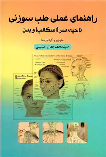 راهنمای عملی طب سوزنی : ناحیه سر و بدن